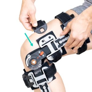 مکانیزم Fast Fit زانوبند بعد از عمل جراحی